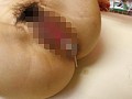 不妊治療クリニックで孕まされて…